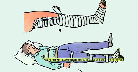 5 tai nạn phổ biến nhất và cách xử lý .