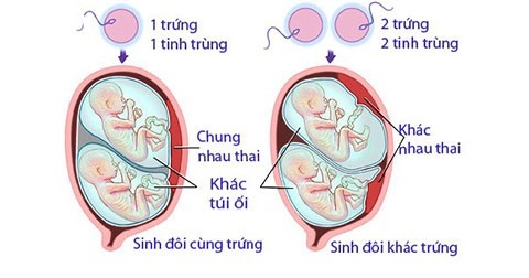 Những thắc mắc của con trai về “nàng” trứng và “chàng” tinh binh