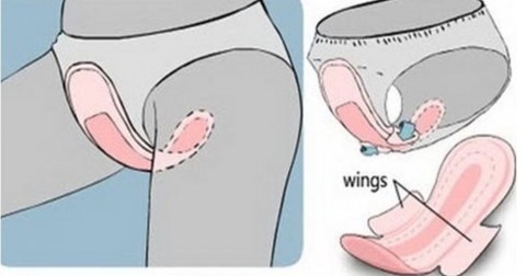 4 sai lầm khi dùng băng vệ sinh phái nữ thường ít lưu tâm