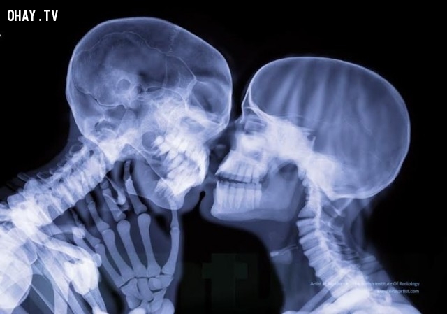 Bạn muốn khám phá cơ thể người của mình từ bên trong? X-quang cơ thể là giải pháp hoàn hảo dành cho bạn! Hãy xem qua những hình ảnh X-quang độc đáo và bổ ích để hiểu rõ hơn về cơ thể của bạn.