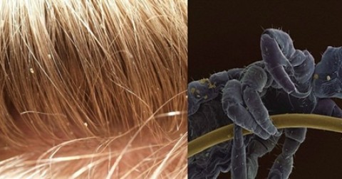 Những hình ảnh lạ lẫm của các vật bình thường dưới ống kính hiển vi
