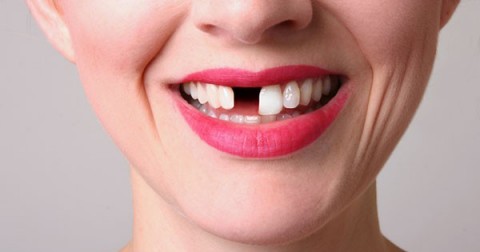 Bạn đã bao giờ gặp ác mộng bị rụng răng? Điều này có nghĩa là…