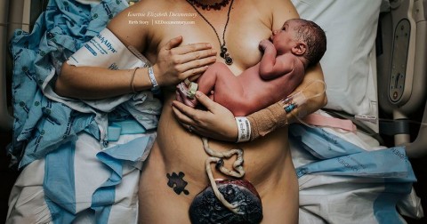 15 bức ảnh ấn tượng từ cuộc thi 'Birth Photo 2017' chứng minh mẹ là người tuyệt nhất thế gian