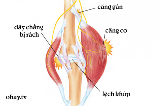 3. Căng cơ ,tập thể hình,căng cơ