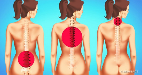 Bài tập giúp giảm đau lưng chỉ với 1 phút mỗi ngày