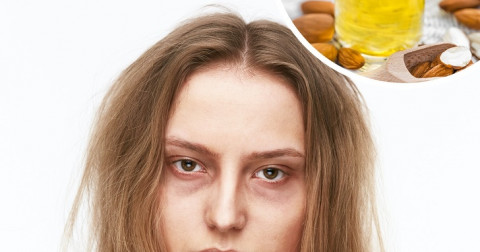 Làm thế nào để khắc phục nhược điểm trên khuôn mặt
