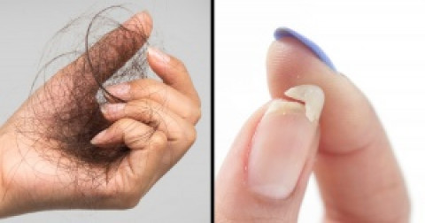 10 thay đổi trên cơ thể cảnh báo về tình trạng sức khỏe của bạn