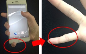 Hội chứng ngón tay bị teo nhỏ do dùng điện thoại