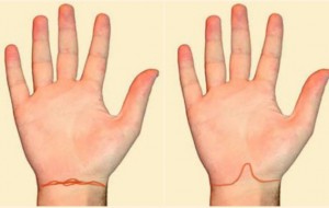 Nhìn ngấn cổ tay đoán số phận, sức khỏe của bạn